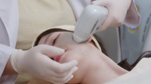 Thermage FLX